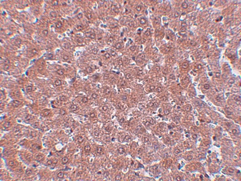 KDM4A Antibody