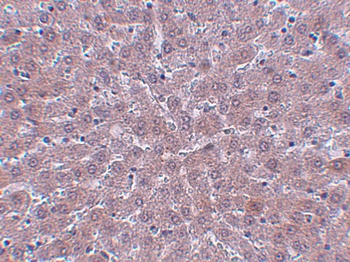 KDM3B Antibody