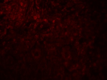MAGEA4 Antibody