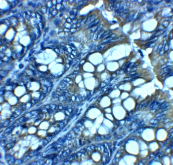 JAGN1 Antibody