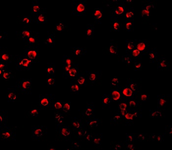 IRS1 Antibody