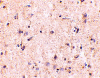 IRGM Antibody