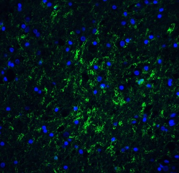 IRGM Antibody