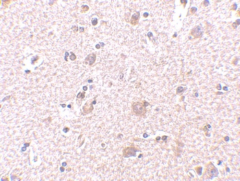 MANF Antibody