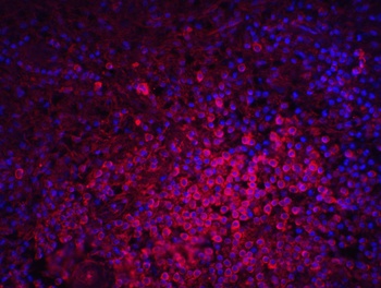 MD-2 Antibody