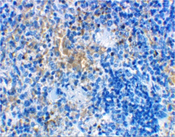 LY96 Antibody