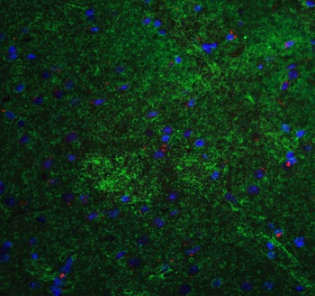 MFN2 Antibody