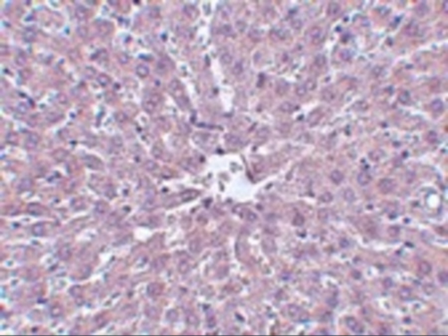 IRAK1 Antibody