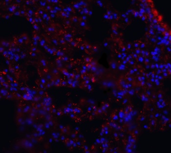 mfsd2aa Antibody