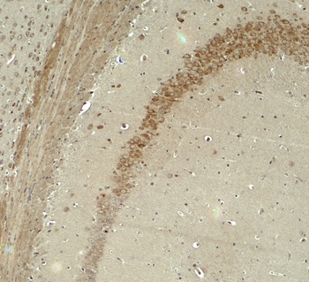 IQSEC2 Antibody