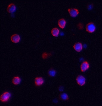 IQSEC1 Antibody