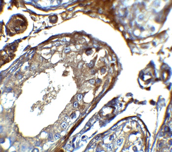 IQCF2 Antibody