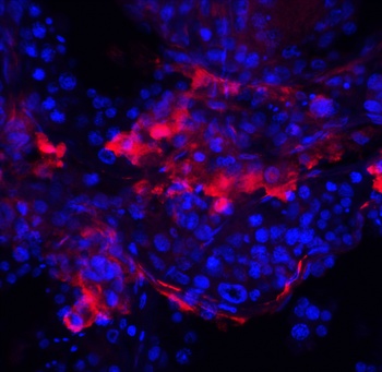 IQCF2 Antibody