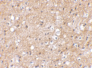 IPR1 Antibody