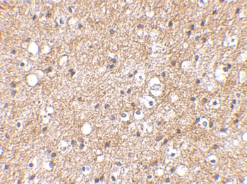 SP110 Antibody