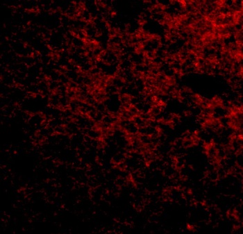 IPR1 Antibody