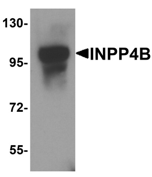 INPP4B Antibody