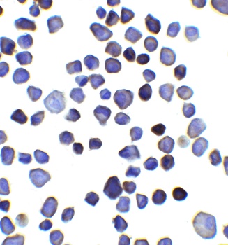 INPP4B Antibody