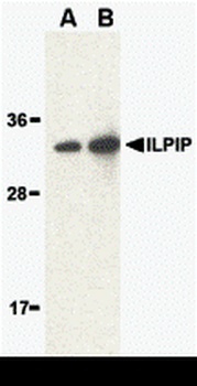 STRADB Antibody