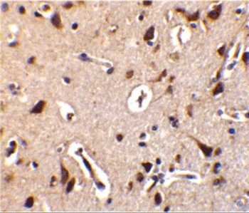 STRADB Antibody
