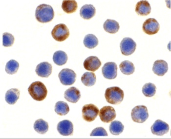 BIRC8 Antibody