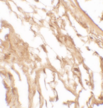 IL-37 Antibody