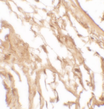 IL37 Antibody