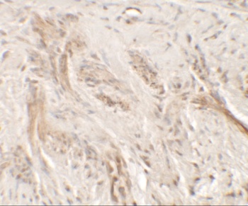 IL-36G Antibody