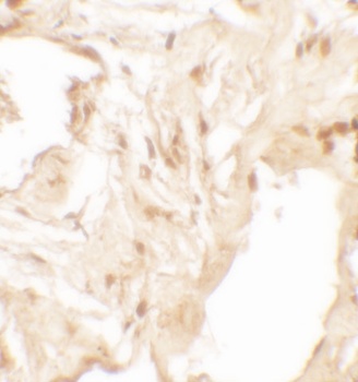 IL-36B Antibody