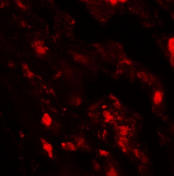IL-36B Antibody