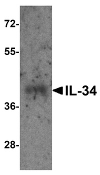 IL34 Antibody