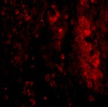 IL33 Antibody