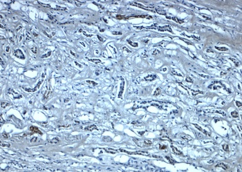 Nephrin Antibody