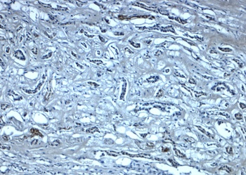 NPHS1 Antibody