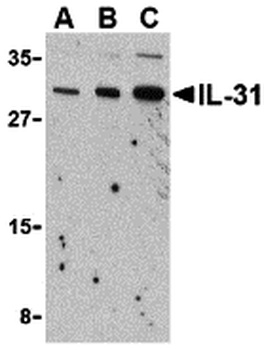IL-31 Antibody