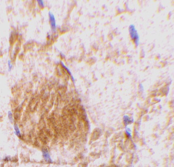 IL-31 Antibody