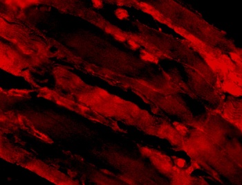 Il31 Antibody