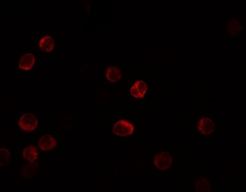 IL-28B Antibody