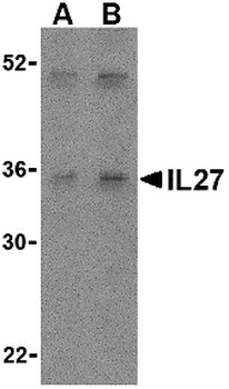 IL27 Antibody