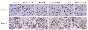 Nephrin Antibody