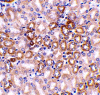Nephrin Antibody