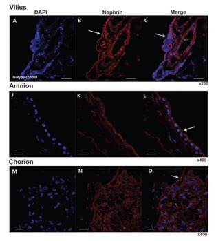 NPHS1 Antibody