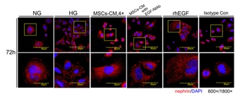 Nephrin Antibody