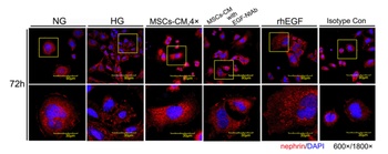 NPHS1 Antibody