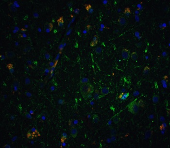 Neurturin Antibody