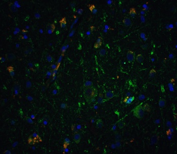 NRTN Antibody