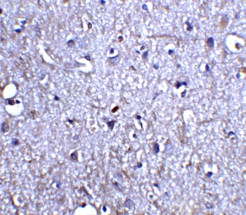 Neurturin Antibody