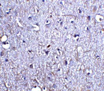 NRTN Antibody