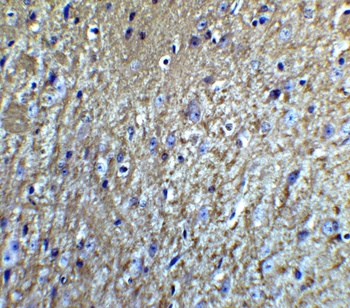 NRTN Antibody