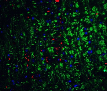 Neurturin Antibody